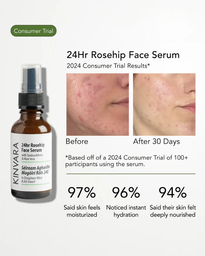 Kinvara 24hr Rosehip Face Serum  30ml - Image 5