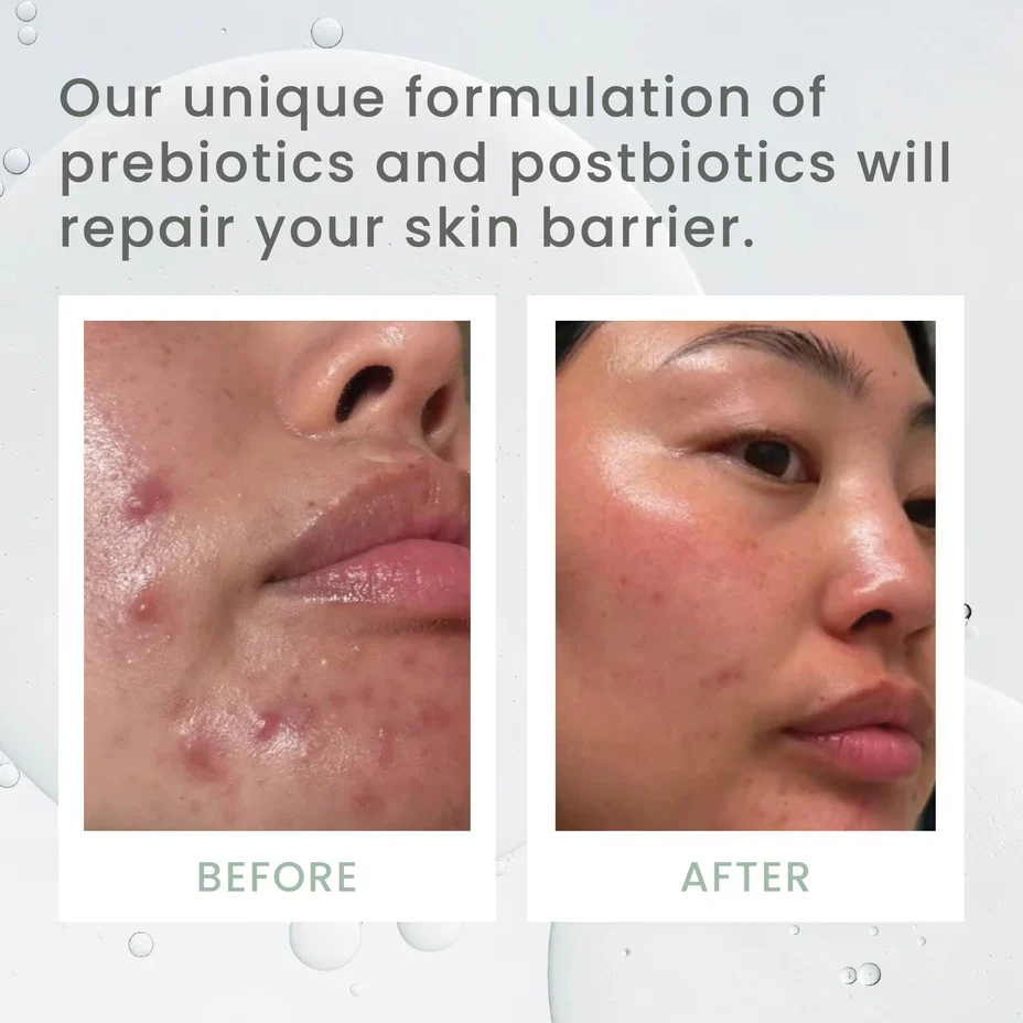 Sásta Microbiome Booster Serum 30ml - Image 5